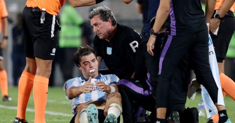 Así quedó la cara de Sosa después del codazo de Rojo