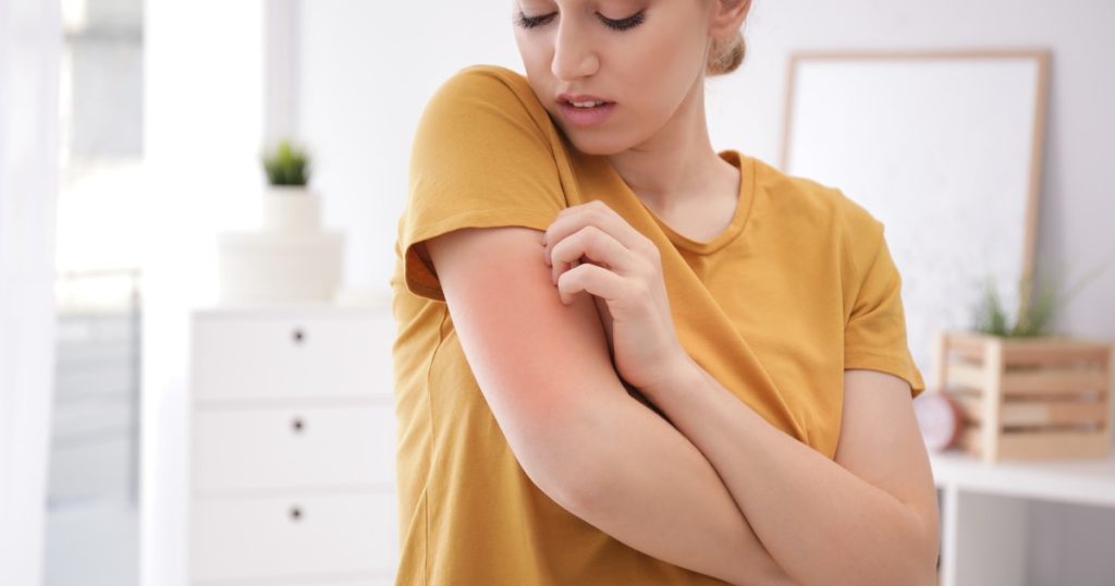 Acné, rosácea y dermatitis: qué cosas de la comida empeoran tu piel y cómo cuidar la microbiota