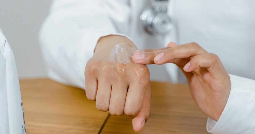 Para qué sirve el jabón de leche de cabra para el eczema: los beneficios y por qué recomiendan usarlo