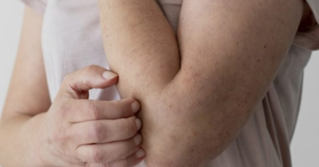 Las 5 señales de daño renal que aparecen en la piel