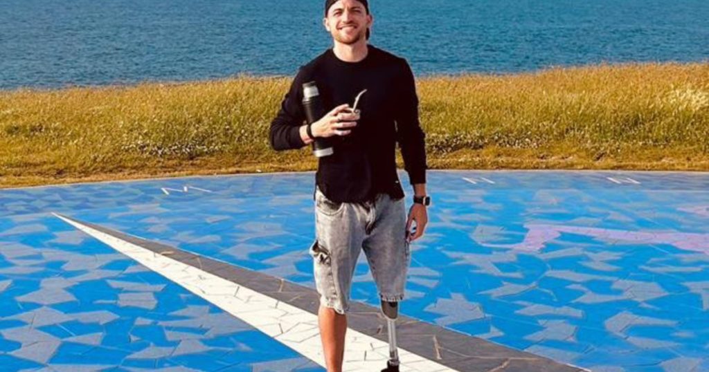 "Papi, no te preocupes que tengo otra": el sobrino de Heinze perdió una pierna y hoy pudo rehacer su vida