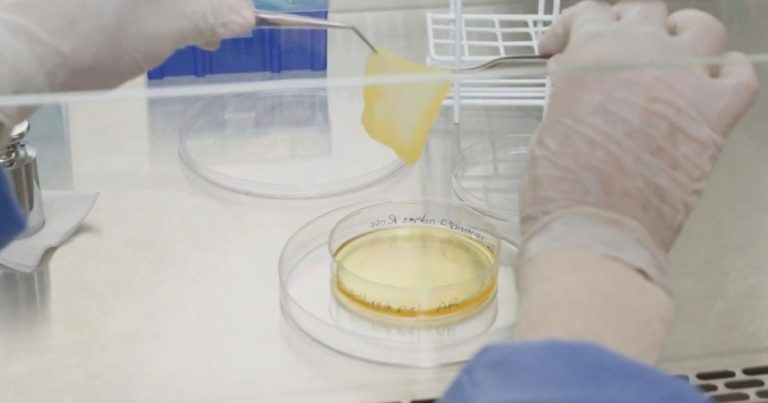 Crean en Argentina una novedosa manera de recuperar la propia piel tras sufrir una quemadura